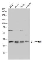 PP1 beta Antibody in Western Blot (WB)