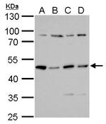 PRKAR2A Antibody in Western Blot (WB)