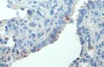 Phospho-FAK (Tyr576) Antibody in Immunohistochemistry (Paraffin) (IHC (P))