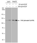 Phospho-FAK (Tyr576) Antibody in Western Blot (WB)