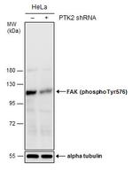 Phospho-FAK (Tyr576) Antibody