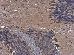 PTPN2 Antibody in Immunohistochemistry (Paraffin) (IHC (P))