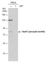 Phospho-RAD17 (Ser645) Antibody in Western Blot (WB)