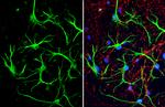 S100B Antibody in Immunocytochemistry (ICC/IF)