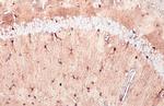 S100B Antibody in Immunohistochemistry (Paraffin) (IHC (P))