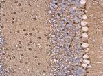 S100B Antibody in Immunohistochemistry (Paraffin) (IHC (P))