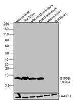 S100B Antibody