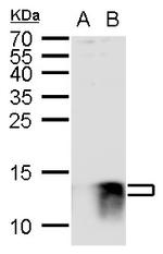 S100B Antibody in Western Blot (WB)