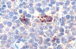 P-Selectin Antibody in Immunohistochemistry (Paraffin) (IHC (P))