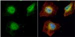 SET Antibody in Immunocytochemistry (ICC/IF)