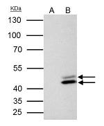 SET Antibody in Immunoprecipitation (IP)