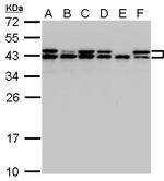 SET Antibody in Western Blot (WB)