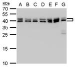 SET Antibody in Western Blot (WB)