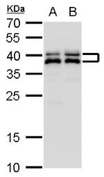 SET Antibody in Western Blot (WB)