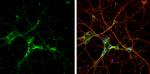 SH3GL1 Antibody in Immunocytochemistry (ICC/IF)