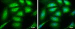 SH3GL1 Antibody in Immunocytochemistry (ICC/IF)