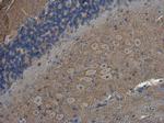 SH3GL1 Antibody in Immunohistochemistry (Paraffin) (IHC (P))