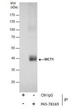 MCT1 Antibody in Immunoprecipitation (IP)
