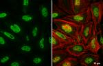 SMARCA2 Antibody in Immunocytochemistry (ICC/IF)