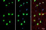 SMARCA2 Antibody in Immunocytochemistry (ICC/IF)