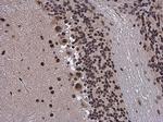 SMARCA2 Antibody in Immunohistochemistry (Paraffin) (IHC (P))