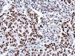 SP3 Antibody in Immunohistochemistry (Paraffin) (IHC (P))