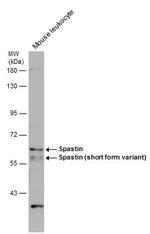 Spastin Antibody in Western Blot (WB)