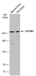 SPTBN1 Antibody in Western Blot (WB)