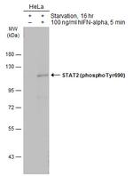 Phospho-STAT2 (Tyr690) Antibody in Western Blot (WB)