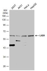 LKB1 Antibody in Western Blot (WB)