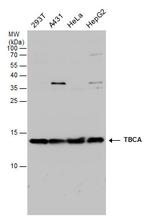 TBCA Antibody in Western Blot (WB)