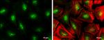 TCF7L2 Antibody in Immunocytochemistry (ICC/IF)