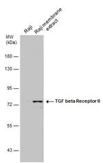 TGFBR2 Antibody in Western Blot (WB)