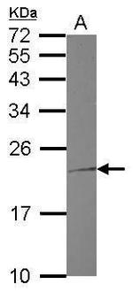 Troponin I Antibody in Western Blot (WB)