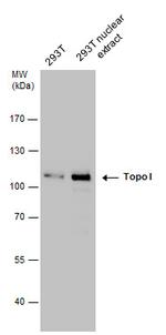 TOP1 Antibody in Western Blot (WB)