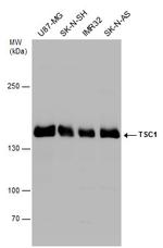 TSC1 Antibody in Western Blot (WB)