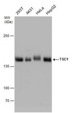 TSC1 Antibody in Western Blot (WB)