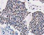 TTF1 Antibody in Immunohistochemistry (Paraffin) (IHC (P))