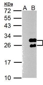 TWIST1 Antibody in Western Blot (WB)