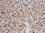 Twist1/Twist2 Antibody in Immunohistochemistry (Paraffin) (IHC (P))