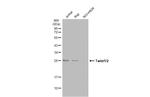 Twist1/Twist2 Antibody in Western Blot (WB)