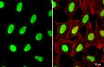 USF2 Antibody in Immunocytochemistry (ICC/IF)