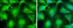 VASP Antibody in Immunocytochemistry (ICC/IF)