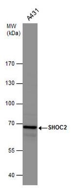 SHOC2 Antibody in Western Blot (WB)