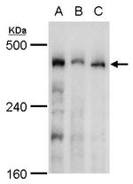 TRRAP Antibody in Western Blot (WB)