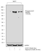 Phospho-ULK1 (Ser555) Antibody in Western Blot (WB)