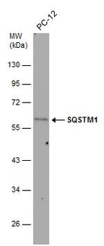 SQSTM1 Antibody in Western Blot (WB)