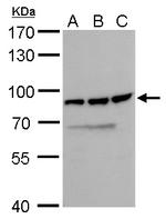 DDX18 Antibody in Western Blot (WB)