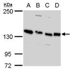 TIMELESS Antibody in Western Blot (WB)