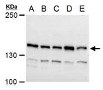 TIMELESS Antibody in Western Blot (WB)